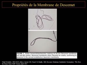 Figure 4- Présence de fibre d’élastine au sein de la membrane de Descemet