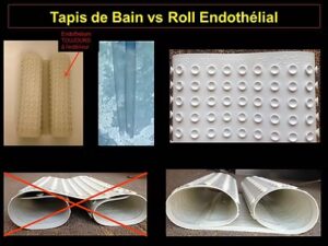 Figure 5 - Nous pouvons comparer l'endothélio-Descemet à un tapis de bain où les petits cercles du tapis de bain représentent les cellules endothéliales