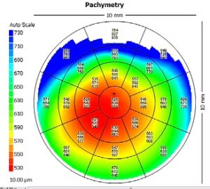 Figure 5_PNG
