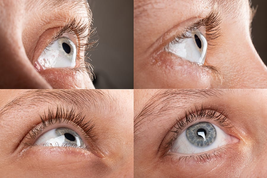 dystrophie cornenne congenitale dr alain saad ophtalmologue paris chirurgien ophtalmo specialiste chirurgie refractive paris dystrophie cornenne congenitale dr alain saad ophtalmologue paris chirurgien ophtalmo specialiste chirurgie refractive paris
