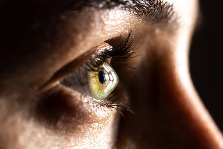 keratocone dr alain saad ophtalmologue paris chirurgien ophtalmo specialiste chirurgie refractive paris keratocone dr alain saad ophtalmologue paris chirurgien ophtalmo specialiste chirurgie refractive paris