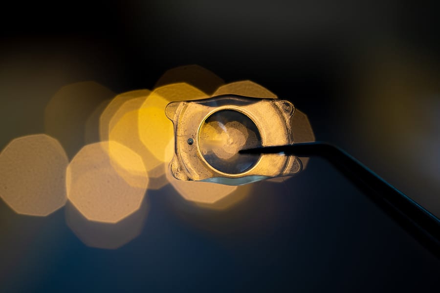 lentilles monofocales intraoculaires cataracte dr alain saad ophtalmologue paris chirurgien ophtalmo specialiste chirurgie refractive paris lentilles monofocales intraoculaires cataracte dr alain saad ophtalmologue paris chirurgien ophtalmo specialiste chirurgie refractive paris